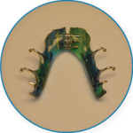 Bryn Mawr Orthodontics Removable Expanders
